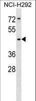 SIGLEC14 Antibody - SIGLEC14 Antibody western blot of NCI-H292 cell line lysates (35 ug/lane). The SIGLEC14 antibody detected the SIGLEC14 protein (arrow).