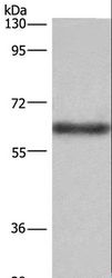 SIGLEC5 / CD170 Antibody - Western blot analysis of Mouse liver tissue, using SIGLEC5 Polyclonal Antibody at dilution of 1:350.