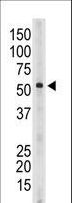SIGLEC6 Antibody - The anti-Siglec6 C-term antibody is used in Western blot to detect Siglec6 in mouse spleen tissue lysate.