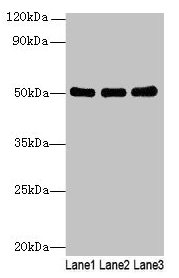 SIGLEC6 Antibody - Western blot All lanes: SIGLEC6 antibody at 6µg/ml Lane 1: Human high value serumLane 2: A549 whole cell lysate Lane 3: Caco-2 whole cell lysate Secondary Goat polyclonal to rabbit IgG at 1/10000 dilution Predicted band size: 50, 39, 49, 38, 43, 45 kDa Observed band size: 50 kDa
