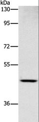 SIGLEC6 Antibody - Western blot analysis of Human placenta tissue, using SIGLEC6 Polyclonal Antibody at dilution of 1:1000.