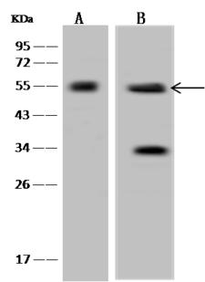 SIGLEC6 Antibody - Anti-SIGLEC6 rabbit polyclonal antibody at 1:500 dilution. Lane A: 293T Whole Cell Lysate. Lane B: NCI-H460 Whole Cell Lysate. Lane C: U-251MG Whole Cell Lysate. Lysates/proteins at 30 ug per lane. Secondary: Goat Anti-Rabbit IgG (H+L)/HRP at 1/10000 dilution. Developed using the ECL technique. Performed under reducing conditions. Predicted band size: 50 kDa. Observed band size: 50 kDa. (We are unsure as to the identity of these extra bands.)