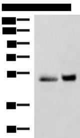 SIGLEC6 Antibody - Western blot analysis of Human right lower lung tissue and Human plasma solution lysates  using SIGLEC6 Polyclonal Antibody at dilution of 1:650