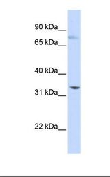 SIGLEC6 Antibody - HepG2 cell lysate. Antibody concentration: 1.0 ug/ml. Gel concentration: 12%.  This image was taken for the unconjugated form of this product. Other forms have not been tested.