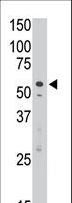 SIGLEC7 / CD328 Antibody - The anti-DSiglec C-term H422 antibody is used in Western blot to detect DSiglec in Jurkat cell lysate.
