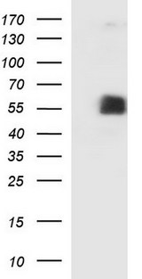 SIGLEC7 / CD328 Antibody - HEK293T cells were transfected with the pCMV6-ENTRY control (Left lane) or pCMV6-ENTRY SIGLEC7 (Right lane) cDNA for 48 hrs and lysed. Equivalent amounts of cell lysates (5 ug per lane) were separated by SDS-PAGE and immunoblotted with anti-SIGLEC7.