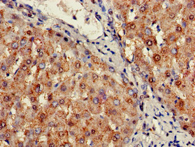 SIGLEC7 / CD328 Antibody - Immunohistochemistry of paraffin-embedded human liver tissue using SIGLEC7 Antibody at dilution of 1:100