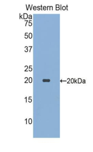 SIGLEC9 Antibody - Western blot of recombinant SIGLEC9 / SIGLEC-9.  This image was taken for the unconjugated form of this product. Other forms have not been tested.