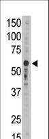 SIGLEC9 Antibody - The anti-Siglec9 C-term antibody is used in Western blot to detect Siglec9 in mouse liver tissue lysate.