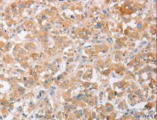 SIGLEC9 Antibody - Immunohistochemistry of paraffin-embedded Human brain using SIGLEC9 Polyclonal Antibody at dilution of 1:40.