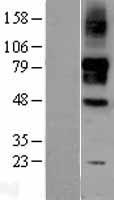 SIGLEC9 Protein - Western validation with an anti-DDK antibody * L: Control HEK293 lysate R: Over-expression lysate