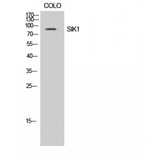 SIK1 / MSK Antibody - Western blot of SIK1 antibody