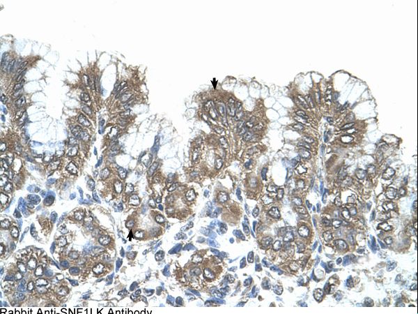 SIK1 / MSK Antibody - SIK1 / SNF1LK antibody SNF1LK(SNF1-like kinase) Antibody was used in IHC to stain formalin-fixed, paraffin-embedded human stomach.  This image was taken for the unconjugated form of this product. Other forms have not been tested.
