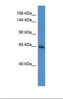 SIK3 / QSK Antibody - Western blot of Human MCF7 . SIK3 antibody dilution 1.0 ug/ml.  This image was taken for the unconjugated form of this product. Other forms have not been tested.