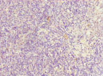 SIK3 / QSK Antibody - Immunohistochemistry of paraffin-embedded human thymus tissue at dilution 1:100