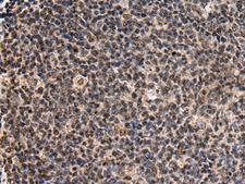 SIK3 / QSK Antibody - Immunohistochemistry of paraffin-embedded Human tonsil tissue  using SIK3 Polyclonal Antibody at dilution of 1:60(×200)