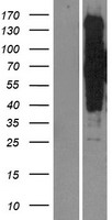 SIK3 / QSK Protein - Western validation with an anti-DDK antibody * L: Control HEK293 lysate R: Over-expression lysate