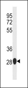 SIKE1 Antibody - MOUSE Sike1 Antibody western blot of mouse liver tissue lysates (35 ug/lane). The MOUSE Sike1 antibody detected the MOUSE Sike1 protein (arrow).