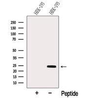 SIKE1 Antibody - Western blot analysis of extracts of HEK293 cells using SIKE1 antibody. The lane on the left was treated with blocking peptide.