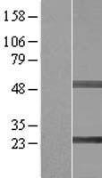 SIKE1 Protein - Western validation with an anti-DDK antibody * L: Control HEK293 lysate R: Over-expression lysate