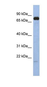 SIM1 Antibody - Western Blot of SIM1 antibody. Immunoblot showing pancreas tissue detected with 0.2-1 ug/ml SIM1 antibody
