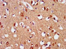 SIM2 Antibody - Immunohistochemistry image at a dilution of 1:400 and staining in paraffin-embedded human brain tissue performed on a Leica BondTM system. After dewaxing and hydration, antigen retrieval was mediated by high pressure in a citrate buffer (pH 6.0) . Section was blocked with 10% normal goat serum 30min at RT. Then primary antibody (1% BSA) was incubated at 4 °C overnight. The primary is detected by a biotinylated secondary antibody and visualized using an HRP conjugated SP system.