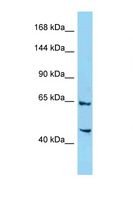 SIMC1 Antibody - 4732471D19Rik antibody Western blot of Mouse Liver lysate. Antibody concentration 1 ug/ml.  This image was taken for the unconjugated form of this product. Other forms have not been tested.