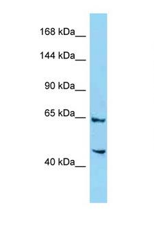 SIMC1 Antibody - 4732471D19Rik antibody Western blot of Mouse Liver lysate. Antibody concentration 1 ug/ml.  This image was taken for the unconjugated form of this product. Other forms have not been tested.