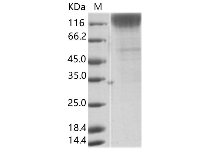 SIV gp120 Protein - Recombinant SIV (isolate 216.94.A2) gp120 Protein (His Tag)