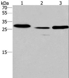 SIMPL / IRAK1BP1 Antibody - Western blot analysis of Human fetal liver tissue and mouse heart tissue,human testis tissue, using IRAK1BP1 Polyclonal Antibody at dilution of 1:475.