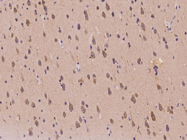 SIMPL / IRAK1BP1 Antibody - Immunochemical staining of human IRAK1BP1 in human brain with rabbit polyclonal antibody at 1:100 dilution, formalin-fixed paraffin embedded sections.
