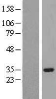 SIMPL / IRAK1BP1 Protein - Western validation with an anti-DDK antibody * L: Control HEK293 lysate R: Over-expression lysate