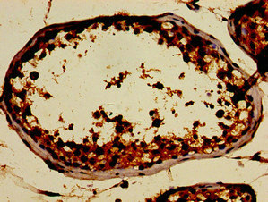 SIN3A Antibody - Immunohistochemistry image of paraffin-embedded human testis tissue at a dilution of 1:100