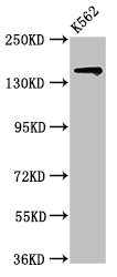 SIN3A Antibody - Positive Western Blot detected in K562 whole cell lysate. All lanes: SIN3A antibody at 2 µg/ml Secondary Goat polyclonal to rabbit IgG at 1/50000 dilution. Predicted band size: 146 KDa. Observed band size: 146 KDa