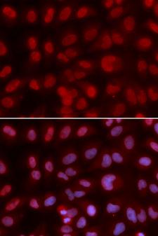 SIN3A Antibody - Immunofluorescence analysis of U2OS cells using SIN3A antibody. Blue: DAPI for nuclear staining.