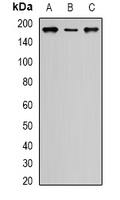 SIN3A Antibody - Western blot analysis of SIN3A expression in HeLa (A); MCF7 (B); COS7 (C) whole cell lysates.