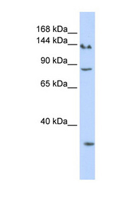 SIN3A Antibody - SIN3A antibody Western blot of HeLa lysate. This image was taken for the unconjugated form of this product. Other forms have not been tested.