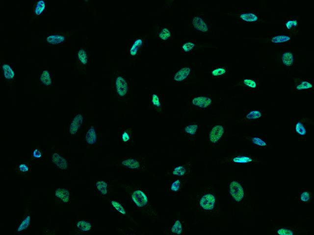 SIN3A Antibody - Immunofluorescence staining of SIN3A in HeLa cells. Cells were fixed with 4% PFA, permeabilzed with 0.1% Triton X-100 in PBS, blocked with 10% serum, and incubated with rabbit anti-Human SIN3A polyclonal antibody (dilution ratio 1:1000) at 4°C overnight. Then cells were stained with the Alexa Fluor 488-conjugated Goat Anti-rabbit IgG secondary antibody (green) and counterstained with DAPI (blue). Positive staining was localized to Nucleus.