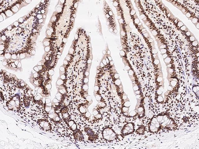 SIN3A Antibody - Immunochemical staining of human SIN3A in human duodenum with rabbit polyclonal antibody at 1:300 dilution, formalin-fixed paraffin embedded sections.