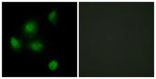 SIN3B Antibody - Immunofluorescence analysis of HeLa cells, using SIN3B Antibody. The picture on the right is blocked with the synthesized peptide.