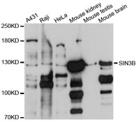 SIN3B Antibody - Western blot analysis of extracts of various cell lines, using SIN3B antibody at 1:1000 dilution. The secondary antibody used was an HRP Goat Anti-Rabbit IgG (H+L) at 1:10000 dilution. Lysates were loaded 25ug per lane and 3% nonfat dry milk in TBST was used for blocking. An ECL Kit was used for detection and the exposure time was 60s.