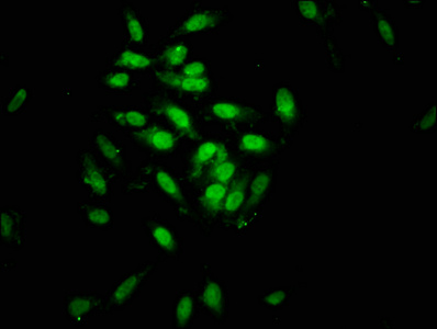 SIN3B Antibody - Immunofluorescence staining of Hela cells at a dilution of 1:133, counter-stained with DAPI. The cells were fixed in 4% formaldehyde, permeabilized using 0.2% Triton X-100 and blocked in 10% normal Goat Serum. The cells were then incubated with the antibody overnight at 4 °C.The secondary antibody was Alexa Fluor 488-congugated AffiniPure Goat Anti-Rabbit IgG (H+L) .