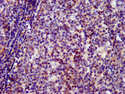 SIN3B Antibody - Immunohistochemistry image at a dilution of 1:400 and staining in paraffin-embedded human tonsil tissue performed on a Leica BondTM system.