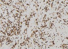 SIN3B Antibody - 1:100 staining human gastric tissue by IHC-P. The sample was formaldehyde fixed and a heat mediated antigen retrieval step in citrate buffer was performed. The sample was then blocked and incubated with the antibody for 1.5 hours at 22°C. An HRP conjugated goat anti-rabbit antibody was used as the secondary.