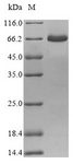 Sindbis Virus Structural polyprotein Protein - (Tris-Glycine gel) Discontinuous SDS-PAGE (reduced) with 5% enrichment gel and 15% separation gel.
