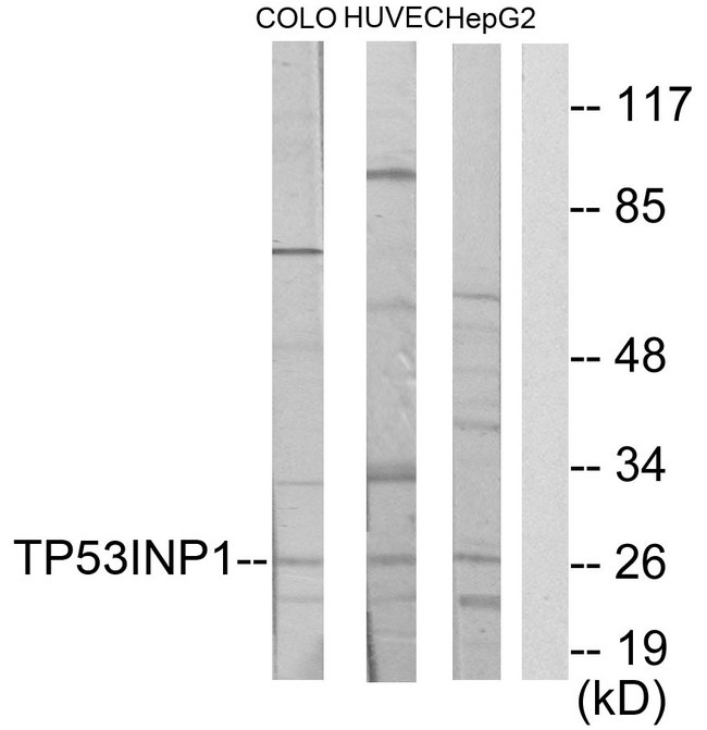 SIP / TP53INP1 Antibody - Western blot analysis of lysates from COLO205, HUVEC, and HepG2 cells, using TP53INP1 Antibody. The lane on the right is blocked with the synthesized peptide.