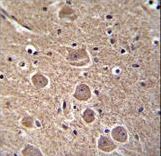 SIP / TP53INP1 Antibody - TP53INP1 Antibody immunohistochemistry of formalin-fixed and paraffin-embedded human brain tissue followed by peroxidase-conjugated secondary antibody and DAB staining.