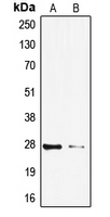 SIP / TP53INP1 Antibody - Western blot analysis of TP53INP1 expression in HeLa (A); HepG2 (B) whole cell lysates.
