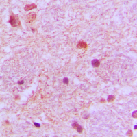 SIP / TP53INP1 Antibody - Immunohistochemical analysis of TP53INP1 staining in human brain formalin fixed paraffin embedded tissue section. The section was pre-treated using heat mediated antigen retrieval with sodium citrate buffer (pH 6.0). The section was then incubated with the antibody at room temperature and detected using an HRP conjugated compact polymer system. DAB was used as the chromogen. The section was then counterstained with hematoxylin and mounted with DPX.
