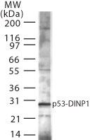 SIP / TP53INP1 Antibody - Western blot of p53DINP1 expression in mouse spleen using antibody at 1:5000 dilution.